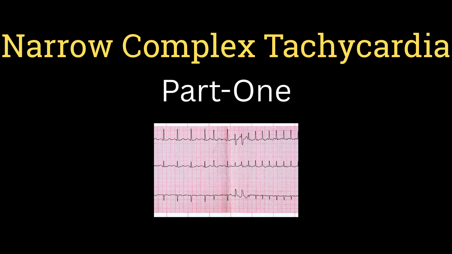 <h1><strong>Narrow Complex Tachycardia</strong></h1>