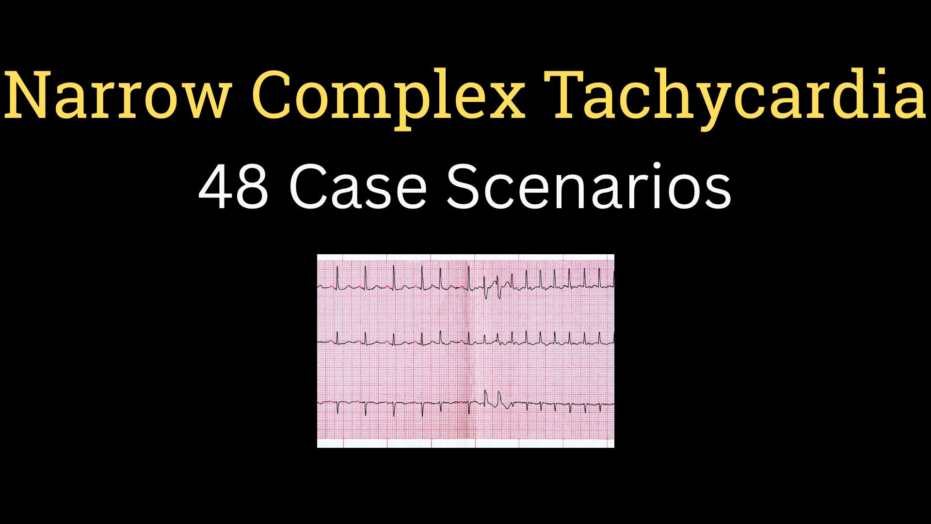 <h1><strong>Narrow Complex Tachycardia Cases</strong></h1>
