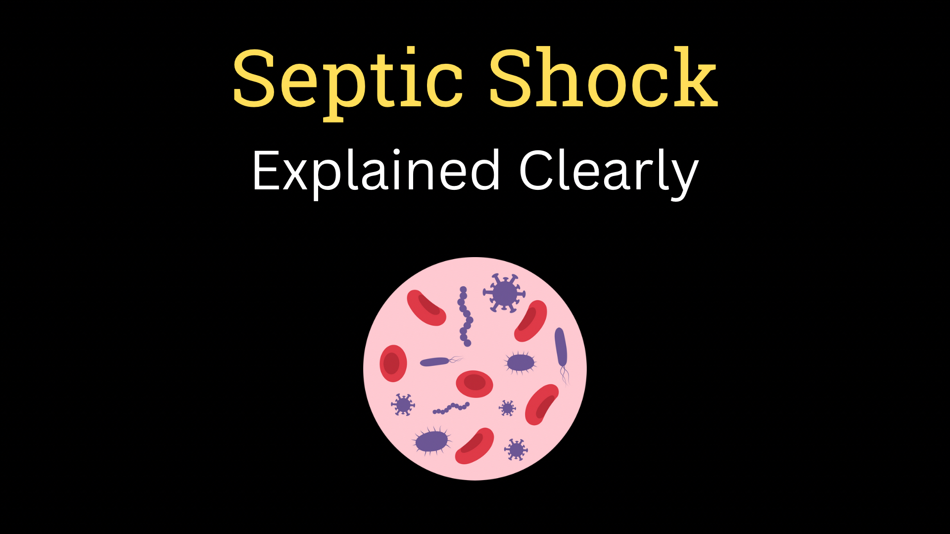 <h1><strong>Septic Shock</strong></h1>