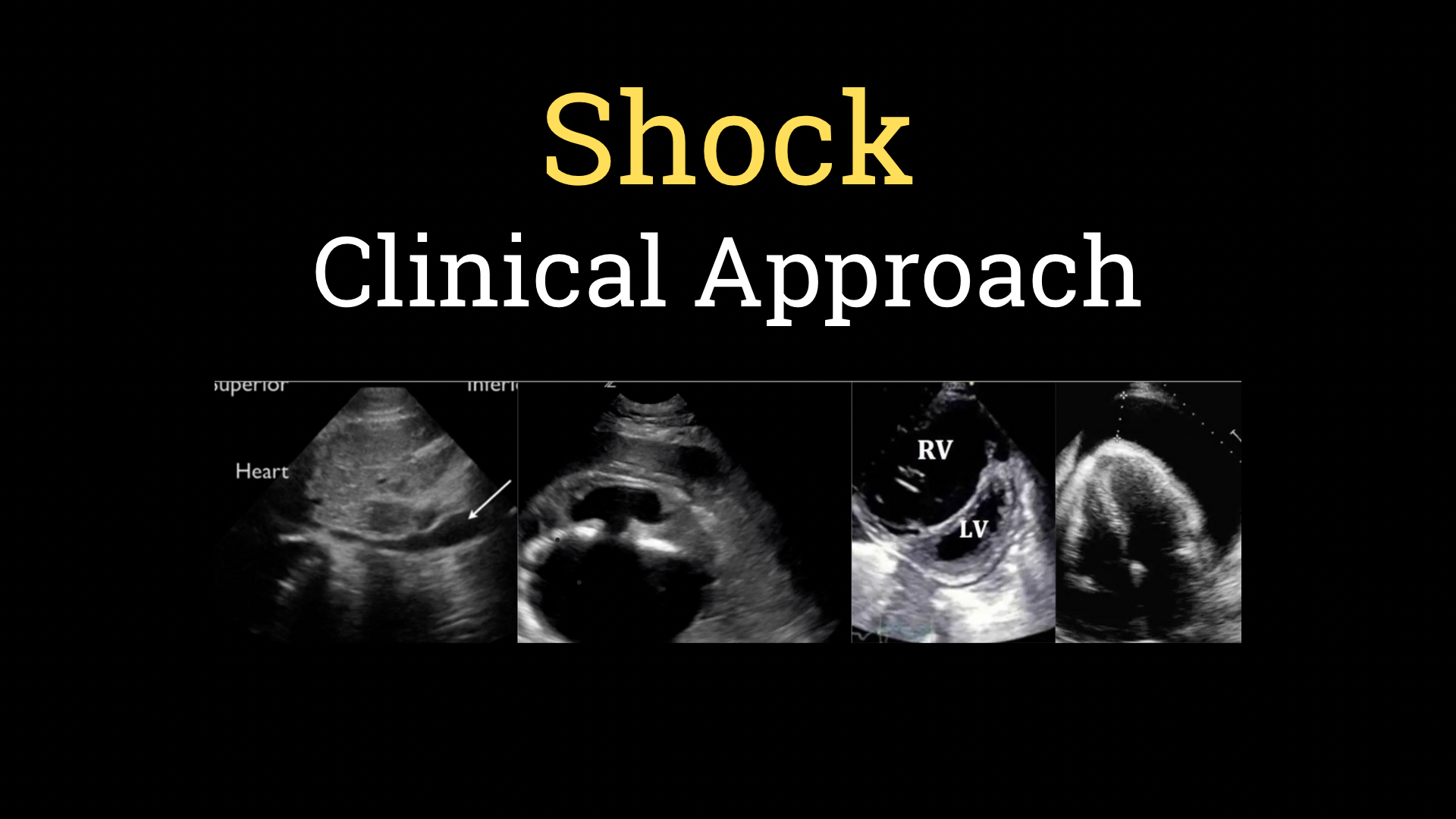 <h1><strong>Clinical Approach to Shock</strong></h1>