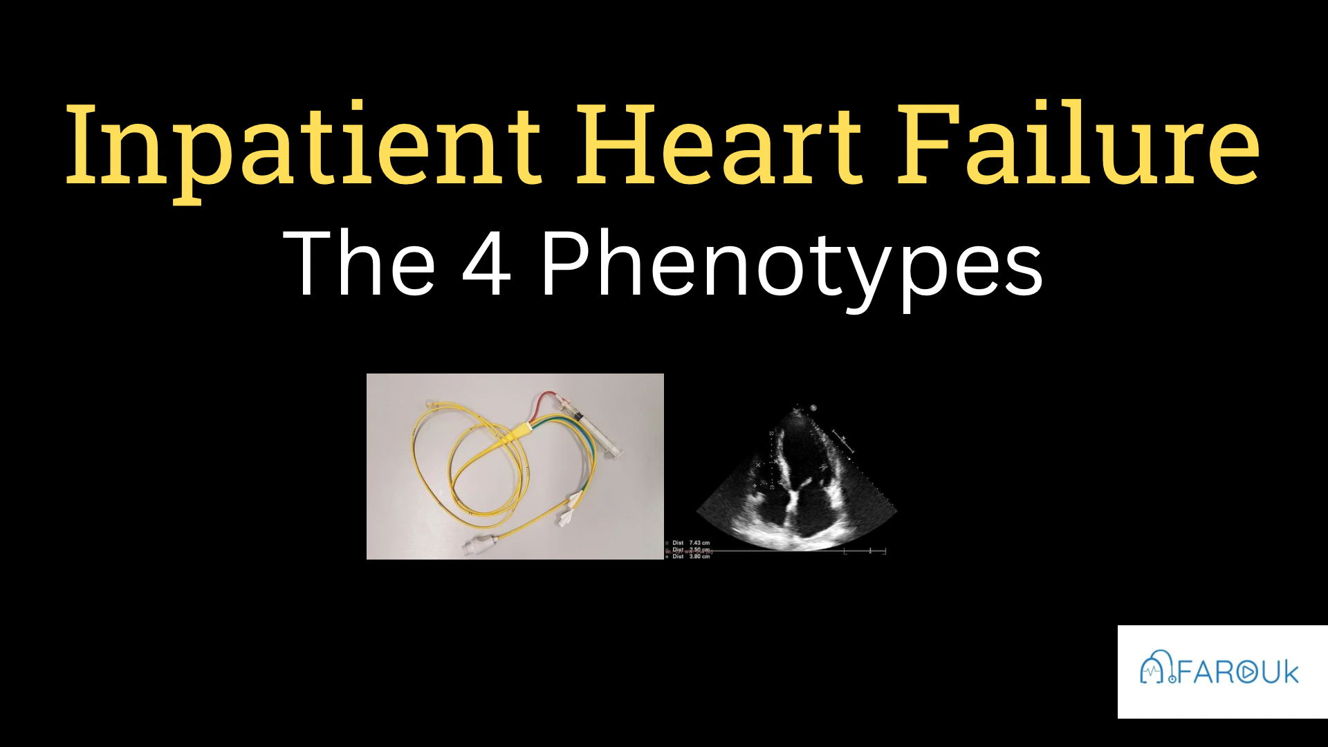 <h1><strong>Inpatient Management of Heart Failure</strong></h1>