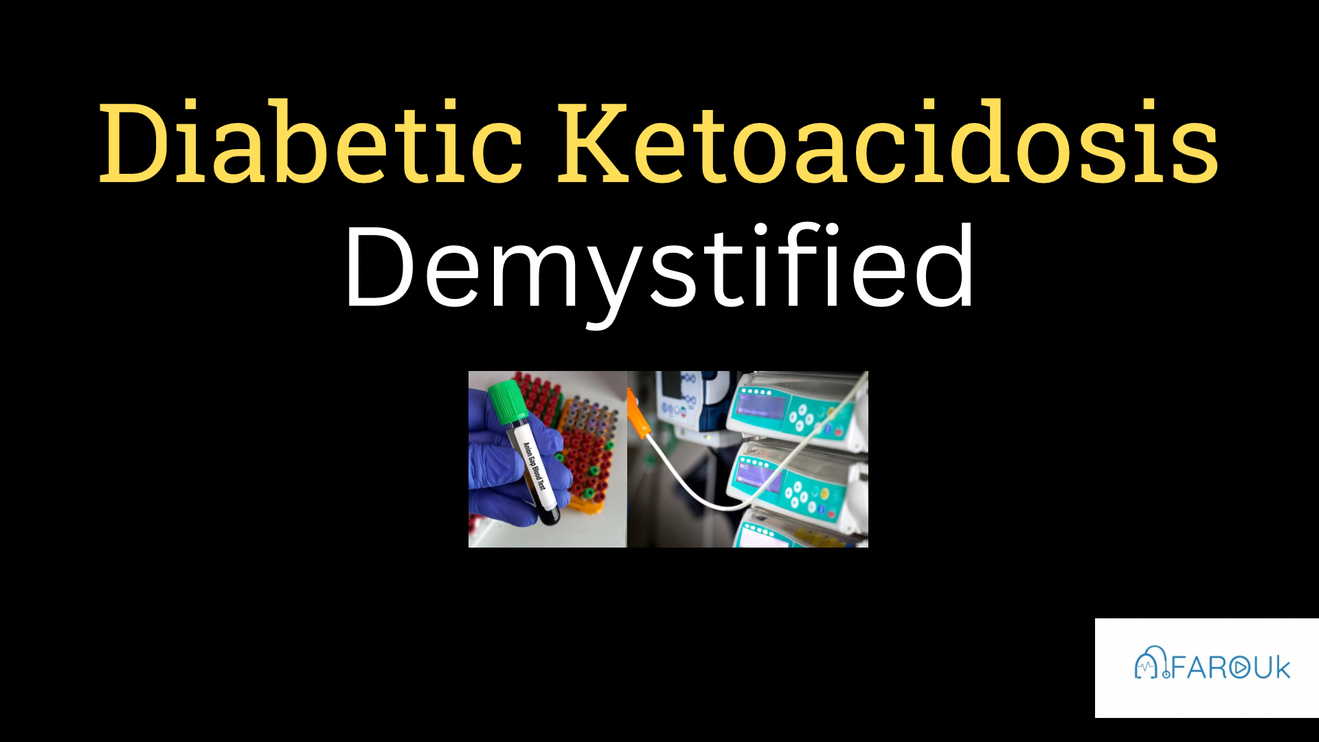 <h1><strong>Diabetic Ketoacidosis</strong></h1>