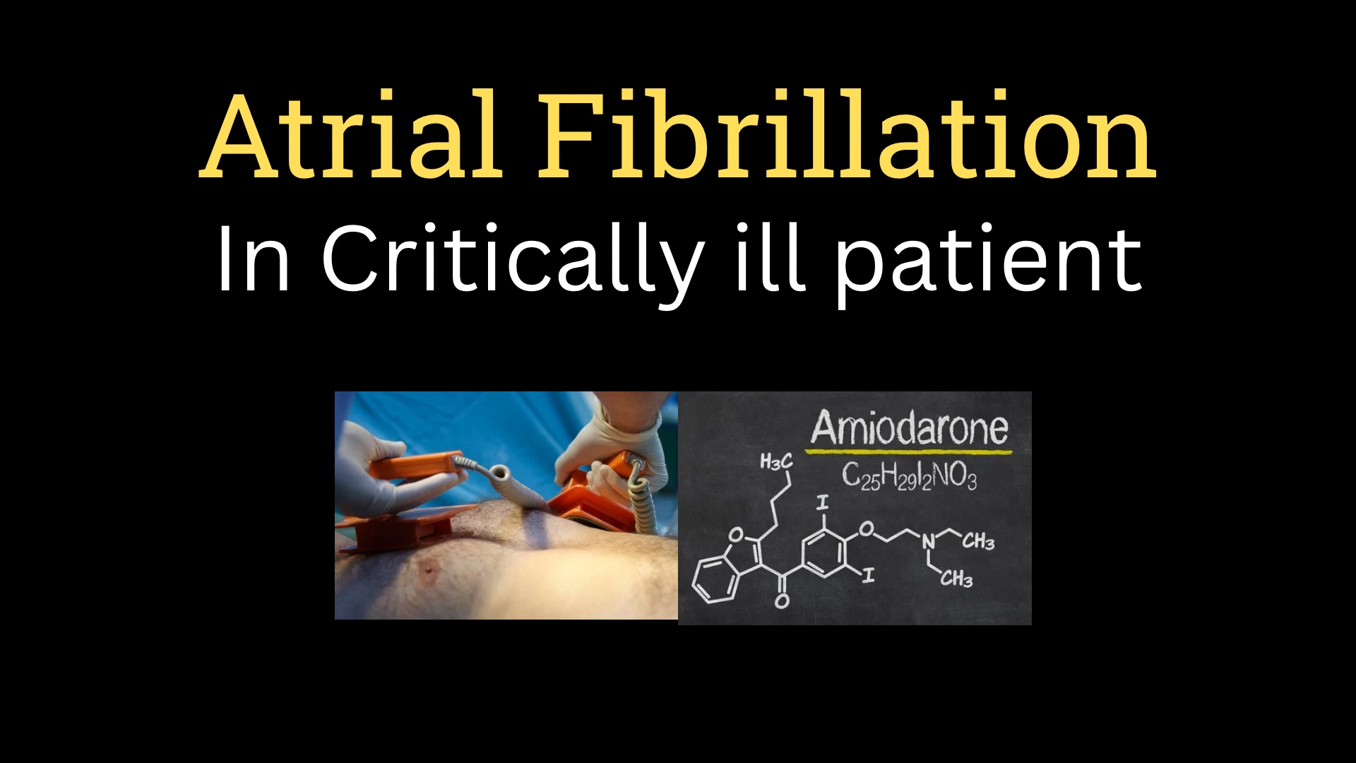 <h1><strong>Atrial Fibrillation in critical illness</strong></h1>