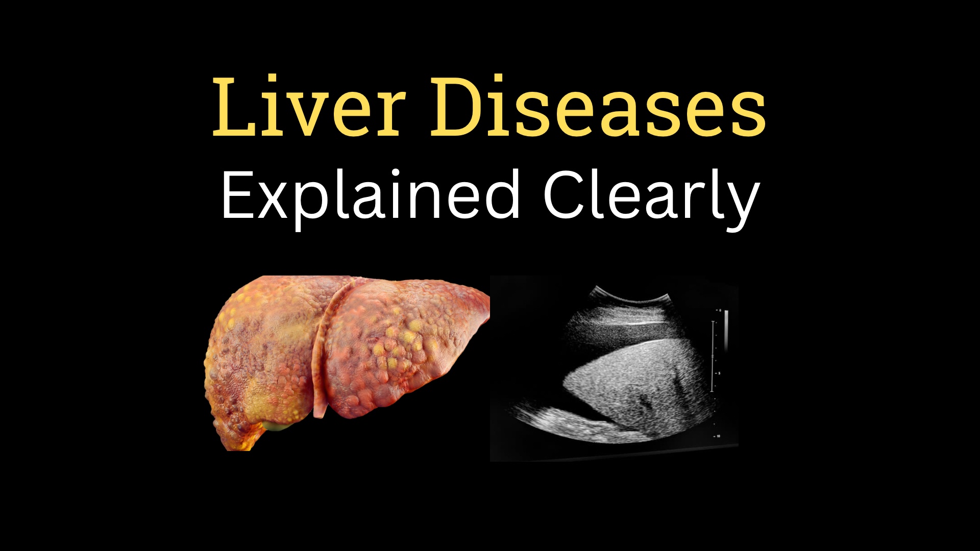 <h1><strong>Liver Disease—Part 01</strong></h1>