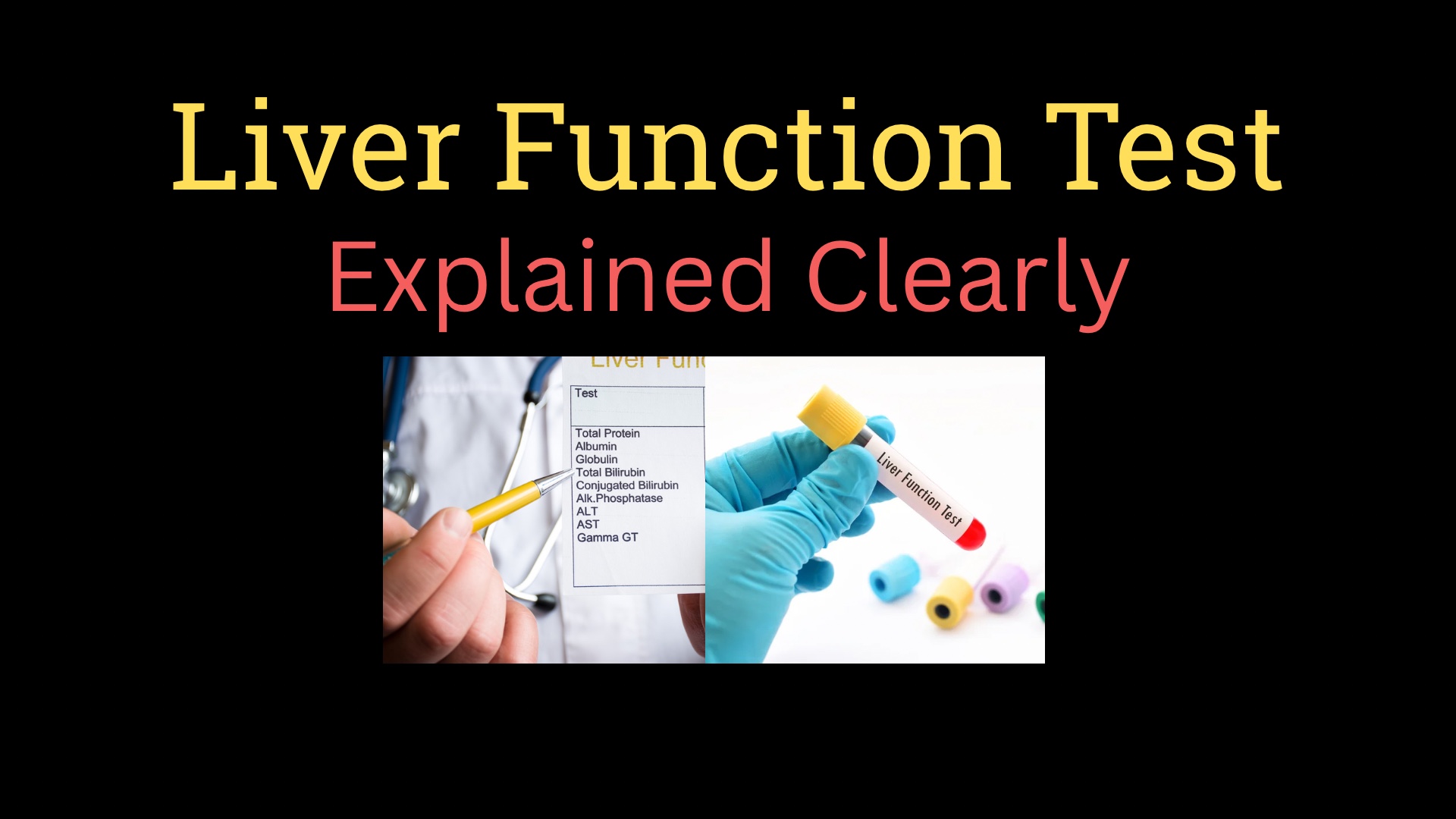 <h1><strong>Liver function test</strong></h1>